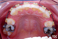 �Q�������Ɏg�p���铧���u���P�b�g