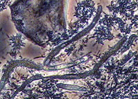 歯周病の原因菌